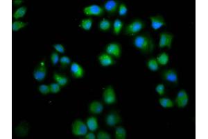 Immunofluorescence staining of Hela cells with ABIN7158363 at 1:66, counter-stained with DAPI.