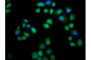 Immunofluorescence staining of Hela cells with ABIN7158363 at 1:66, counter-stained with DAPI. (LMO7 anticorps  (AA 1301-1465))
