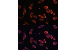 Immunofluorescence analysis of L929 cells using RB antibody (ABIN6128601, ABIN6146597, ABIN6146598 and ABIN6223325) at dilution of 1:100.
