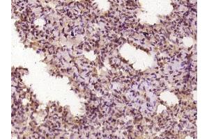 anti-Polymerase (DNA Directed), delta 1, Catalytic Subunit 125kDa (POLD1) (AA 101-200) antibody