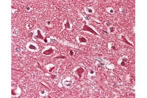 Human Brain, Cortex: Formalin-Fixed, Paraffin-Embedded (FFPE)