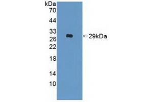 Detection of Recombinant IFNa/bR2, Human using Polyclonal Antibody to Interferon Alpha/Beta Receptor 2 (IFNa/bR2) (IFNAR2 anticorps  (AA 27-243))