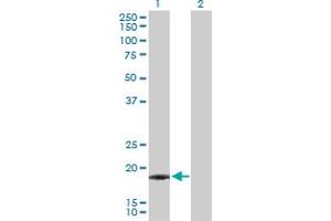 Western Blot analysis of IFNA21 expression in transfected 293T cell line by IFNA21 MaxPab polyclonal antibody. (IFNA21 anticorps  (AA 1-189))