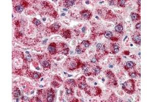 ABIN185651 (2µg/ml) staining of paraffin embedded Human Liver. (Catalase anticorps  (Internal Region))