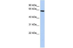 WB Suggested Anti-CCDC96 Antibody Titration: 0. (CCDC96 anticorps  (N-Term))