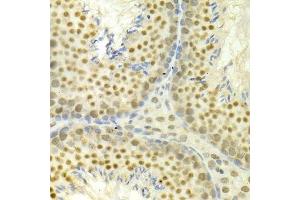 Immunohistochemistry of paraffin-embedded mouse testis using MAPK3 Antibody.