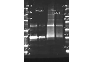 Goat anti Uricase antibody was used to detect purified Uricase under reducing and non-reducing conditions. (Urate Oxidase anticorps)