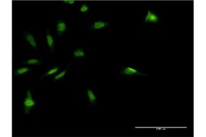 Immunofluorescence of monoclonal antibody to MDFI on HeLa cell.