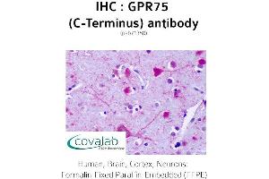 Image no. 1 for anti-G Protein-Coupled Receptor 75 (GPR75) (C-Term) antibody (ABIN1735162) (GPR75 anticorps  (C-Term))