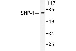 Image no. 1 for anti-Protein-tyrosine Phosphatase 1C (PTPN6) antibody (ABIN271911) (SHP1 anticorps)