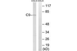 Western blot analysis of extracts from COLO cells, using C9 Antibody. (C9 anticorps  (AA 181-230))