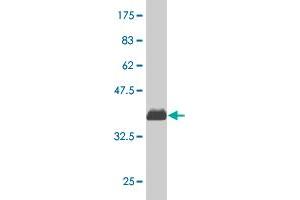 Western Blot detection against Immunogen (35. (CDK4 anticorps  (AA 211-303))