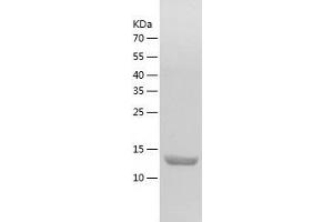 Regenerating Islet-Derived 1 beta (REG1B) (AA 24-166) protein (His-IF2DI Tag)