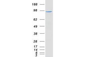 Validation with Western Blot