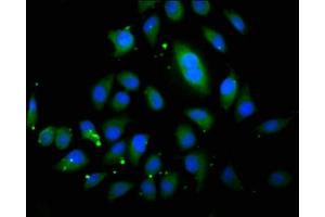 Immunofluorescence staining of A549 cells with ABIN7163123 at 1:200, counter-stained with DAPI.