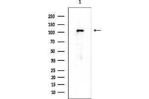 anti-N-Acylsphingosine Amidohydrolase (Non-Lysosomal Ceramidase) 2 (ASAH2) antibody