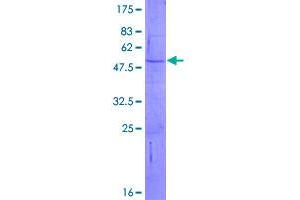 Image no. 1 for ADAM Metallopeptidase with thrombospondin Type 1 Motif, 12 (ADAMTS12) (AA 1-229) protein (GST tag) (ABIN7540279)