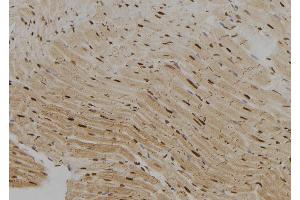ABIN6279426 at 1/100 staining Rat heart tissue by IHC-P. (KHSRP anticorps  (N-Term))