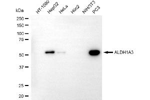Western blotting analysis using ALDH1A3 antibody (ABIN7797558). (ALDH1A3 anticorps)