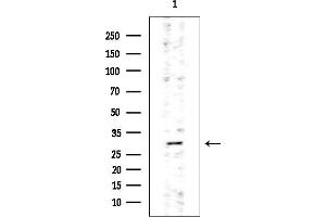 anti-Mesenchyme Homeobox 2 (MEOX2) (Internal Region) antibody