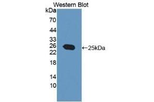 Detection of Recombinant MGMT, Human using Polyclonal Antibody to O-6-Methylguanine DNA Methyltransferase (MGMT) (MGMT anticorps  (AA 1-207))