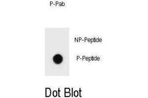 Dot Blot (DB) image for anti-Receptor tyrosine-protein kinase erbB-2 (ErbB2/Her2) (pThr1172) antibody (ABIN3001984)