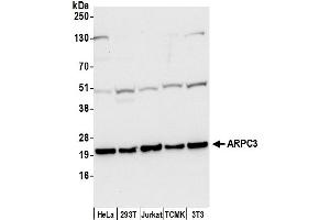Western Blotting (WB) image for anti-Actin Related Protein 2/3 Complex, Subunit 3, 21kDa (ARPC3) (AA 1-50) antibody (ABIN7449983)