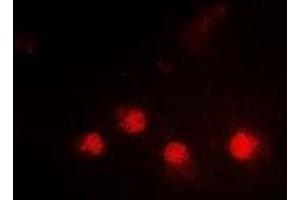 Immunofluorescent analysis of SMARCAD1 staining in HepG2 cells. (SMARCAD1 anticorps)