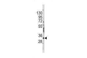 Western blot analysis of anti-STAP1 Antibody (F56) in mouse kidney tissue lysates (35ug/lane)
