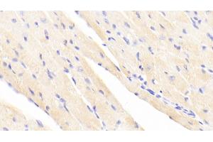 Detection of ACTN2 in Mouse Cardiac Muscle Tissue using Polyclonal Antibody to Actinin Alpha 2 (ACTN2)