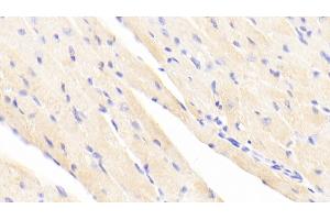 Detection of ACTN2 in Mouse Cardiac Muscle Tissue using Polyclonal Antibody to Actinin Alpha 2 (ACTN2) (ACTN2 anticorps  (AA 1-254))