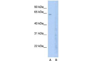Host:  Rabbit  Target Name:  BRD7  Sample Type:  Jurkat  Lane A:  Primary Antibody  Lane B:  Primary Antibody + Blocking Peptide  Primary Antibody Concentration:  2. (BRD7 anticorps  (C-Term))