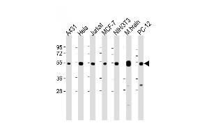 All lanes : Anti-TUBA4A Antibody (C-term) at 1:8000 dilution Lane 1: A431 whole cell lysate Lane 2: Hela whole cell lysate Lane 3: Jurkat whole cell lysate Lane 4: MCF-7 whole cell lysate Lane 5: NIH/3T3 whole cell lysate Lane 6: Mouse brain lysate Lane 7: PC-12 whole cell lysate Lysates/proteins at 20 μg per lane. (TUBA4A anticorps  (C-Term))