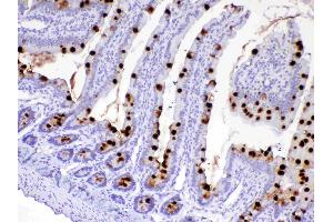 IHC analysis of MUC2 using anti-MUC2 antibody . (MUC2 anticorps)
