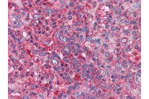 Human Spleen: Formalin-Fixed, Paraffin-Embedded (FFPE) (BIRC3 anticorps)