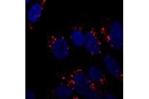 Immunofluorescent staining of ATG5 on SH-SY5Y cells using ATG5 polyclonal antibody  at 1 : 250. (ATG5 anticorps  (AA 1-50))