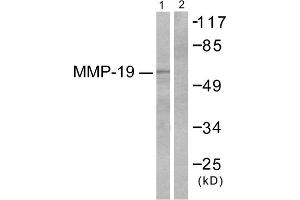 Western blot analysis of extracts from HuvEc cells, using MMP-19 antibody (ABIN2843550). (MMP19 anticorps  (N-Term))