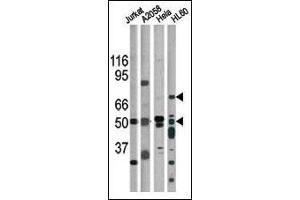 The anti-Phospho-CHK1- Pab (ABIN391324 and ABIN2841354) is used in Western blot for detection in, from left to right, Jurkat, , Hela, and HL60 tissue lysates. (CHEK1 anticorps  (pSer317))