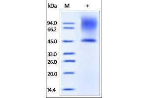 Human Decorin, His Tag on SDS-PAGE under reducing (R) condition. (Decorin Protein (DCN) (AA 17-359) (His tag))