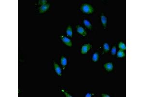Immunofluorescent analysis of A549 cells using ABIN7166096 at dilution of 1:100 and Alexa Fluor 488-congugated AffiniPure Goat Anti-Rabbit IgG(H+L)