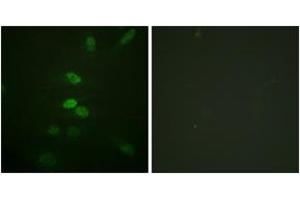 Immunofluorescence analysis of HeLa cells, using CDC25B (Ab-353) Antibody.
