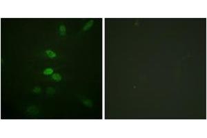 Immunofluorescence analysis of HeLa cells, using CDC25B (Ab-353) Antibody. (CDC25B anticorps  (AA 319-368))