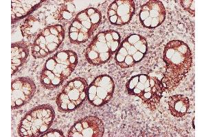 Immunoperoxidase of monoclonal antibody to GSS on formalin-fixed paraffin-embedded human colon tissue.