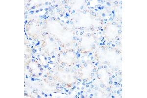 Immunohistochemistry of paraffin-embedded rat kidney using L Rabbit mAb  at dilution of 1:100 (40x lens). (LAMP2 anticorps)