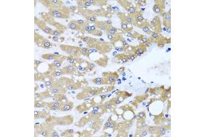 Immunohistochemistry of paraffin-embedded human liver injury using NDUFS3 antibody (ABIN5974479) at dilution of 1/100 (40x lens). (NDUFS3 anticorps)