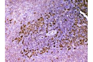 IHC analysis of ADA using anti-ADA antibody .