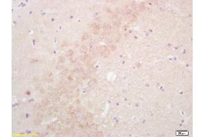 Formalin-fixed and paraffin embedded rat brain labeled with Rabbit Anti SULT1E1/Estrogen Sulfotranferase Polyclonal Antibody, Unconjugated (ABIN671106) at 1:200 followed by conjugation to the secondary antibody and DAB staining (SULT1E1 anticorps  (AA 51-145))