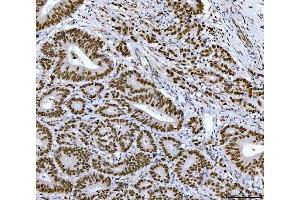 IHC analysis of RCC1 using anti-RCC1 antibody (ABIN7600022). (RCC1 anticorps  (AA 14-421))
