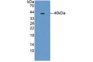 Western blot analysis of recombinant Mouse PLA2R1. (PLA2R1 anticorps  (AA 1418-1487))