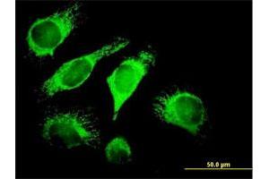 Immunofluorescence of purified MaxPab antibody to DNAJA3 on HeLa cell. (DNAJA3 anticorps  (AA 1-480))